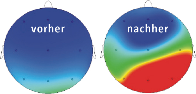 Les bougies auriculaires procurent un effet relaxant, c&rsquo;est prouvé scientifiquement !